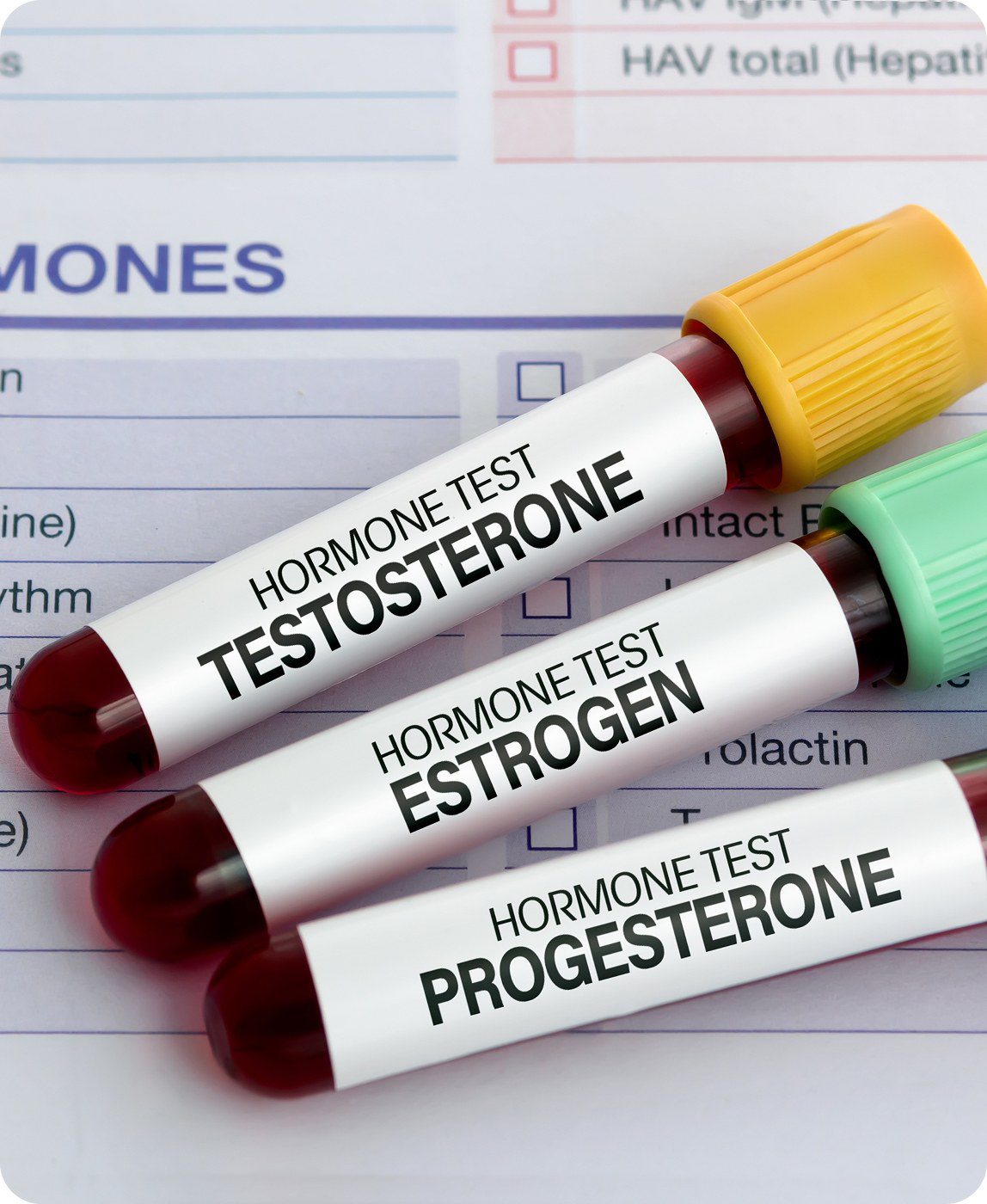 Hormone test tubes for testosterone, estrogen, progesterone.