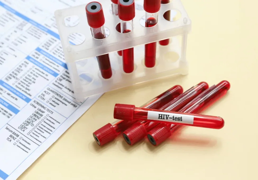 HIV Blood test tubes for stages of HIV