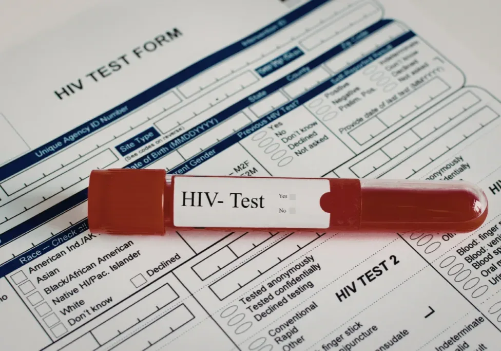 HIV Test