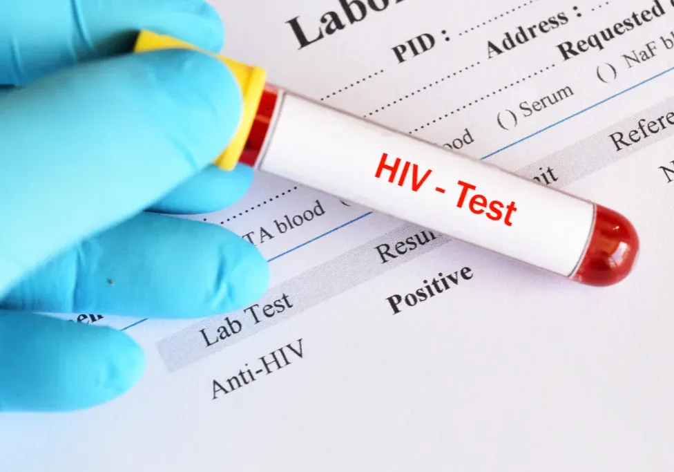 HIV Testing